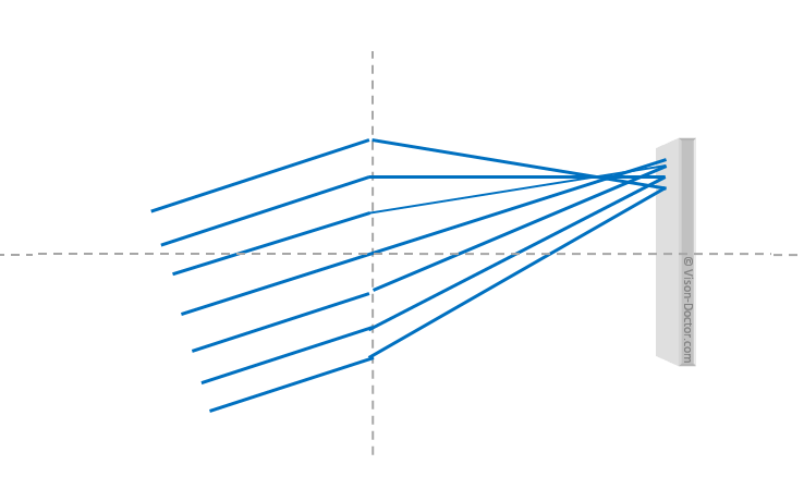 assymetric error of lens (coma)